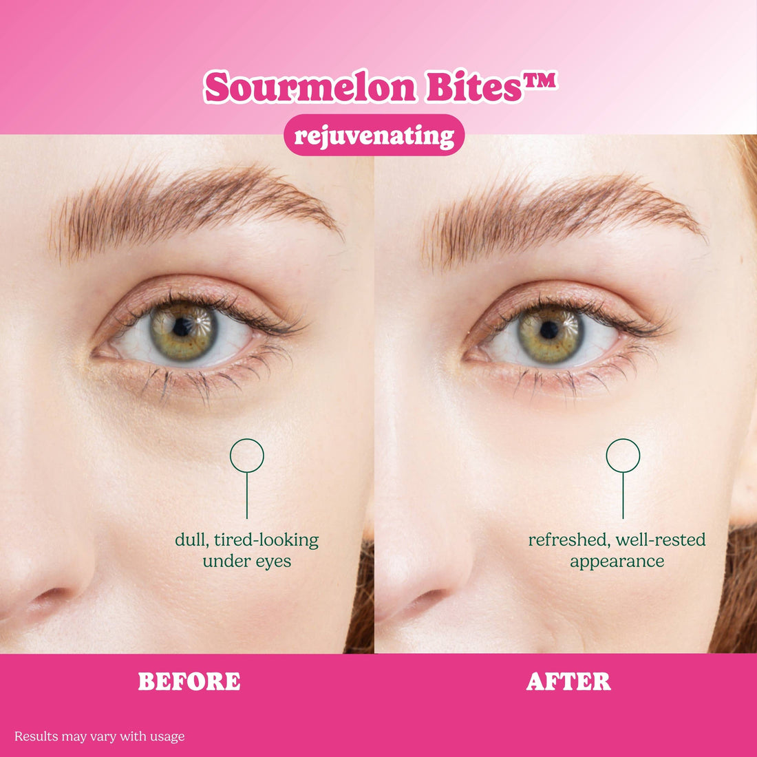 ESW x SmartSweets Rejuvenating Sourmelon Bites™ Eye Patches: 1 pc