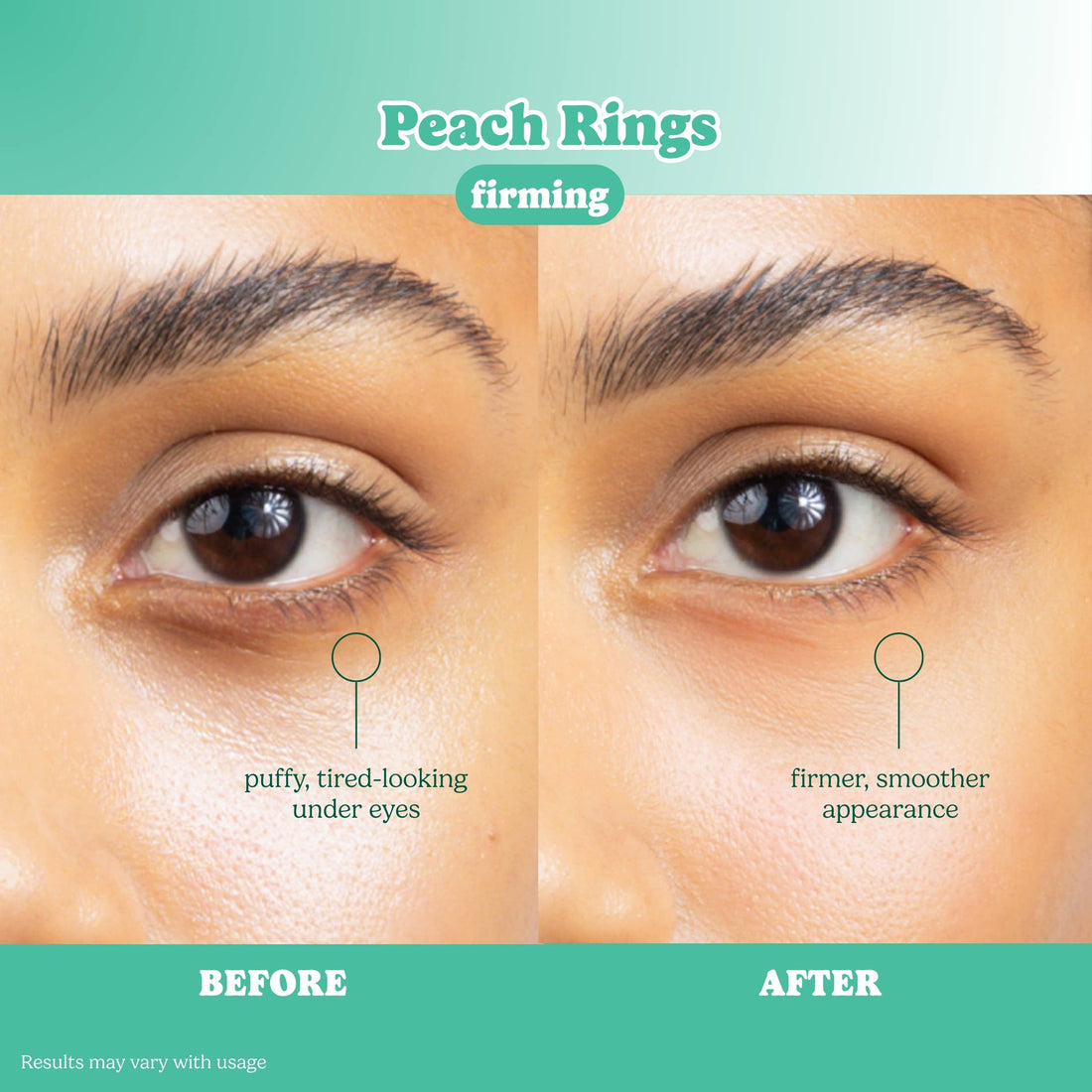 ESW x SmartSweets Firming Peach Rings Eye Patches: 1 pc